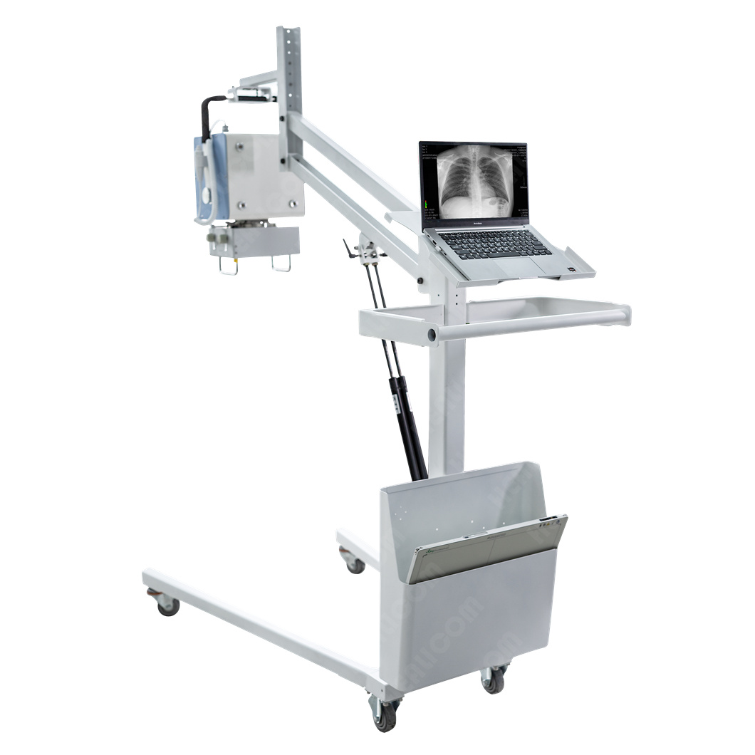 Tragbares mobiles Röntgenfotos – Photography X Ray Bewertung und Preis